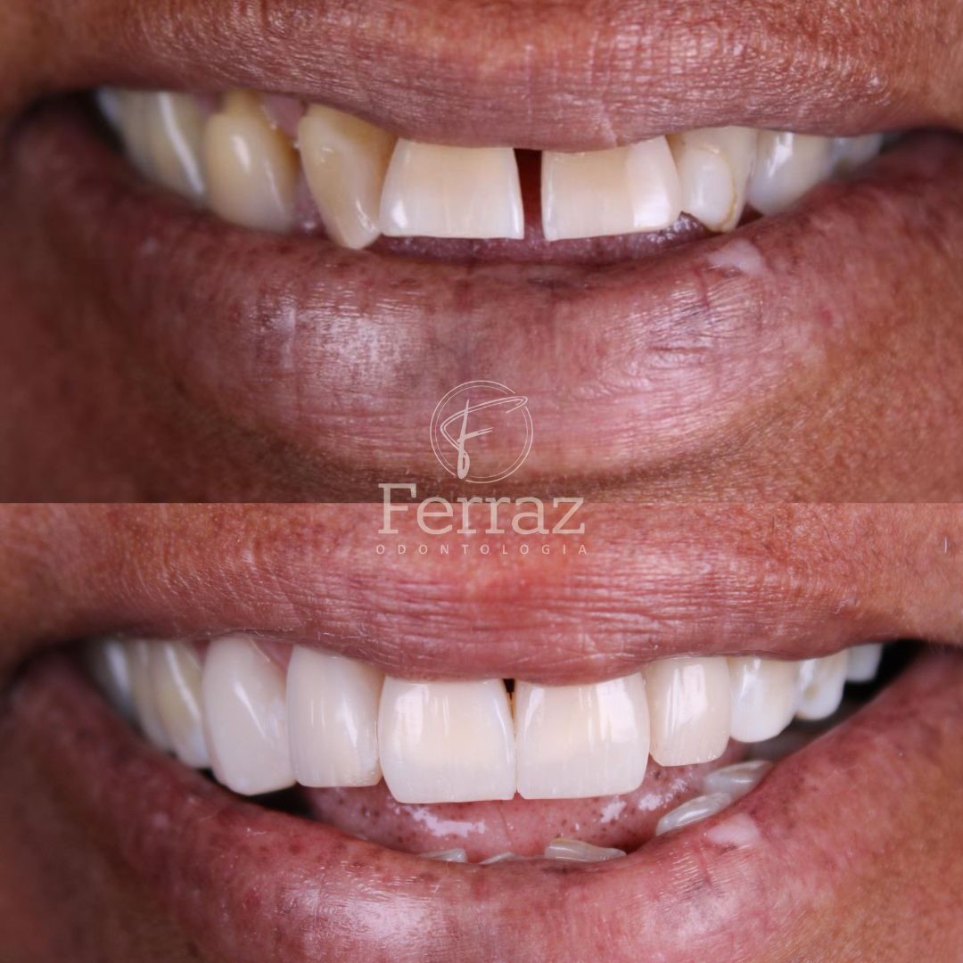 Ferraz Odontologia