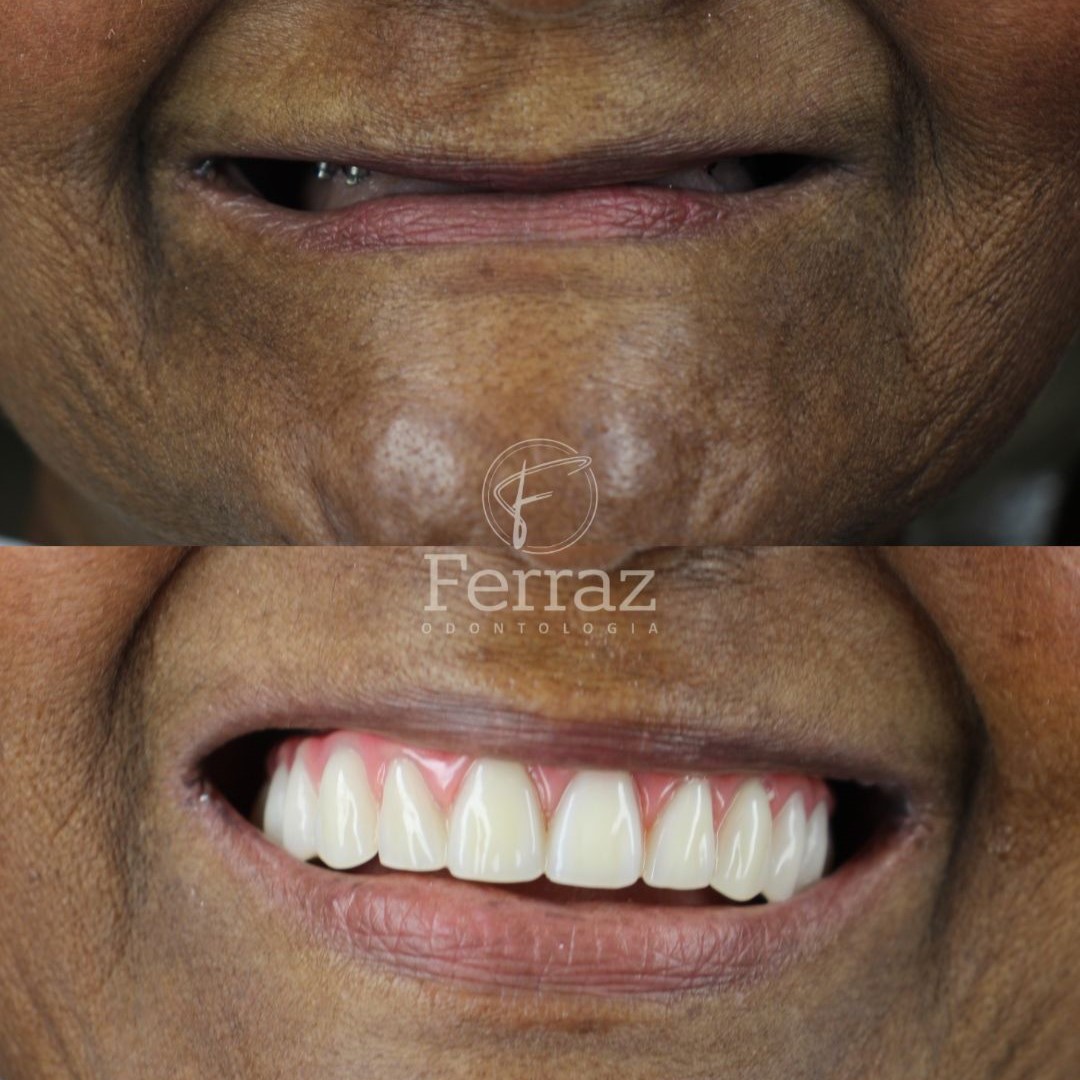 Ferraz Odontologia