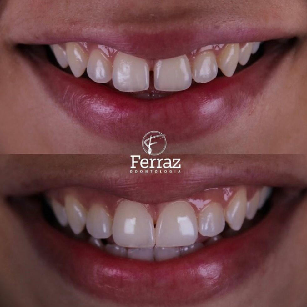 Ferraz Odontologia